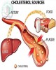 Bài giảng Rối loạn chuyển hóa Lipid và các nguy cơ tim mạch