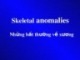 Bài giảng Những bất thường về xương - Skeletal anomalies