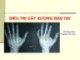 Bài giảng Điều trị gãy xương bàn tay